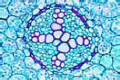 Ranunculus, buttercup, t.s. of a typical dicot root