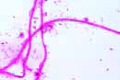 Putrefactive bacteria (Sphaerotilus slide) bacteria
