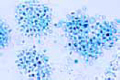 Wasserbluthe (Microcystis slide), blue-green alga blooming in stagnant water