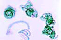 Anabaena slide, blue green algae, in eutrophic water