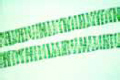 Spirogyra slide, filamentous green alga in nutrient-rich water