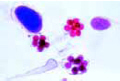 Water mold (Saprolegnia slide), harmful to plants and animals
