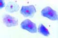 Squamous epithelium slide, isolated cells from human mouth