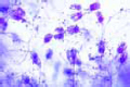 Mold in spoiled foodstuffs