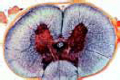 Spinal cord of cat showing white and grey matter, nerve cells slide