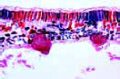 Plasmopara viticola slide, downy mildew of grapes