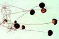 Rhizopus or Mucor, mold slide
