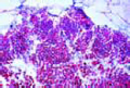 Ustilago zeae, corn smut slide