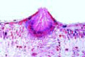 Gymnosporangium sabinae slide, pear rust