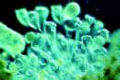 Vorticella slide, marine ciliates