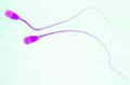 Sperm of bull (spermatozoa slide)