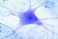Motor nerve cells, smear from spinal cord of cow