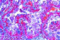 Eimeria stiedae slide, coccidiosis slide, of infected rabbit liver