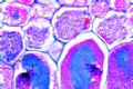 Orchid, t.s. of root showing endotrophic mycorrhiza
