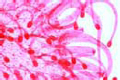 Drosera slide, sundew, w.m. of leaf showing glandular hairs