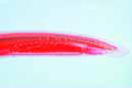 Branchiostoma lanceolatum (Amphioxus slide)