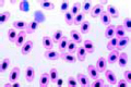 Salamandra, blood smear slide
