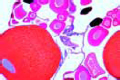 Rana, ovary with developing eggs