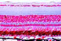 Rana, posterior part of eyeball with retina, sagittal