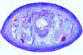 Hirudo medicinalis, medicinal leech