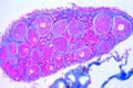 Lumbricus, ovary with developing eggs