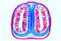 Scorpion slide, section selected to show the poison gland