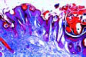 Sarcoptes scabiei slide (Acarus siro)