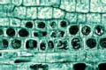 Mitosis slide, l.s. from Allium root tips