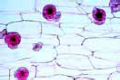 Inulin crystals slide, t.s. of tuber of Dahlia