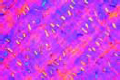 Calcium oxalate crystals slide