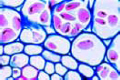 Ranunculus ficaria slide, root storing starch grains