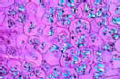 Solanum tuberosum, potato