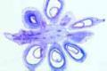 Ranunculus slide, l.s. of fruit