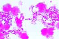 Streptococcus pyogenes slide, smear from pus