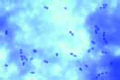 Streptococcus lactis slide, milk souring organism