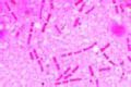 Bacillus anthracis slide, smear from culture