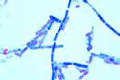 Clostridium septicum slide, smear from culture