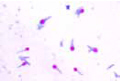 Clostridium tetani slide, special stained to show the terminal spores