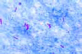 Mycobacterium tuberculosis slide