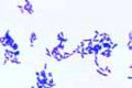 Corynebacterium diphtheriae slide