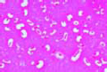 Klebsiella pneumoniae slide (Friedlander slide)