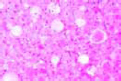 Bacterium erysipelatos slide, (Erysipelothrix rhusiopathiae)