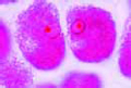 Rhizobium radicicola slide, nitrogen fixing organisms