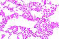 Salmonella enteritidis slide, causes meat poisoning