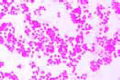 Bacterium prodigiosum slide, (Serratia marcescens)