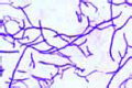 Streptomyces griseus slide, streptomycin antibiotic slide
