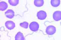 Borrelia duttoni (Spirochaeta recurrentis slide)