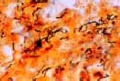 Treponema pallidum (Spirochaeta pallida slide)