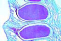 Marchantia, l.s. of antheridial