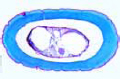 Astacus, antenna (decalcified)